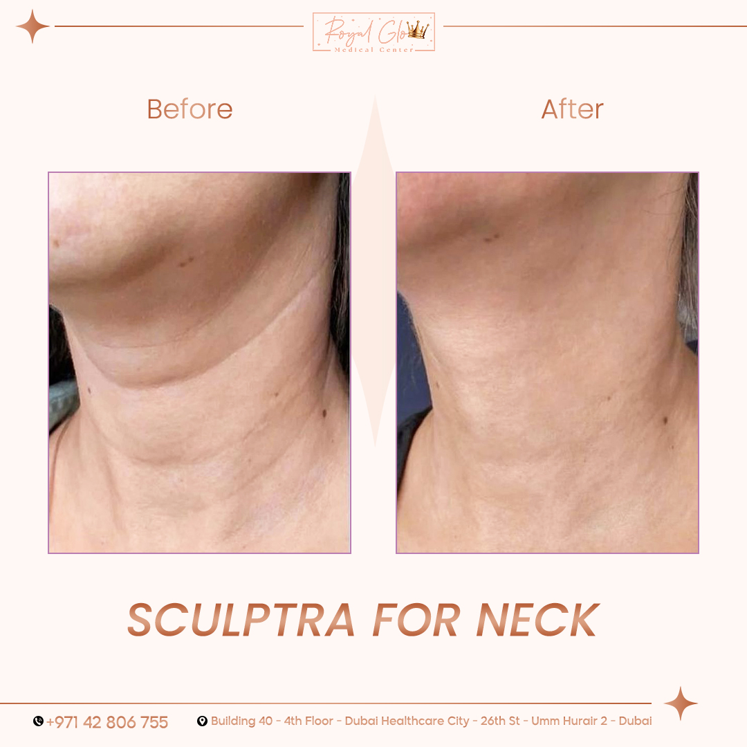 before and after(RG) (9)